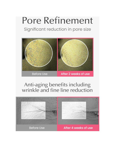 Suero de colágeno 4D Fusidyne 50ml - Hidratante Piel Radiante