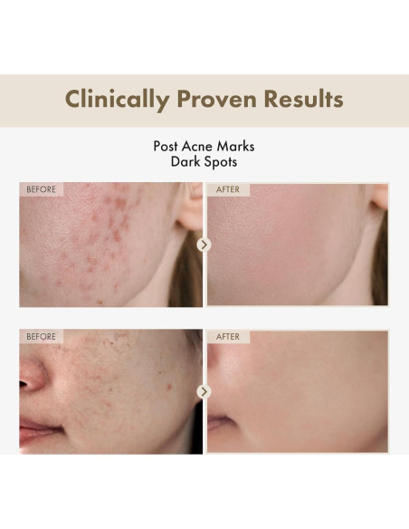 Suero Facial Arbutina Alpha 2% TOSOWOONG 33ml Hidratante