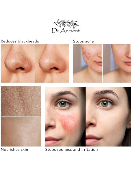 Jabón Natural de Aloe Vera Orgánico Dr.Ancient 140g Hecho a Mano