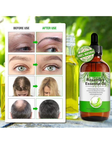 Aceite de Romero Puro 120 ml - Crecimiento Cabello y Piel