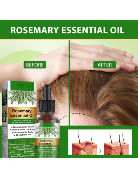 Combo Aceite de Romero Orgánico 4x30ml - Crecimiento Cabello Combo Aceite de Romero Orgánico 4x30ml - Crecimiento Cabello