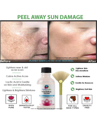 Kit de Peeling Químico Planet Eden 88% Ácido Láctico + Limpiador y Crema