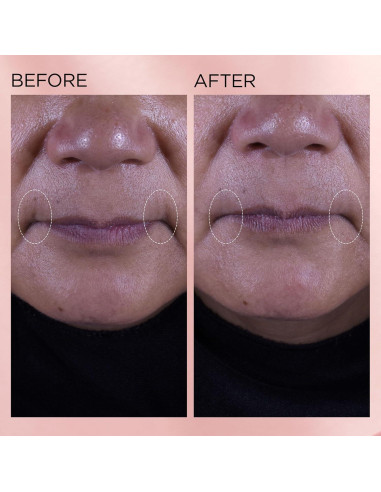 Crema Hidratante Facial Elizabeth Arden Retinol + HPR 50 ml