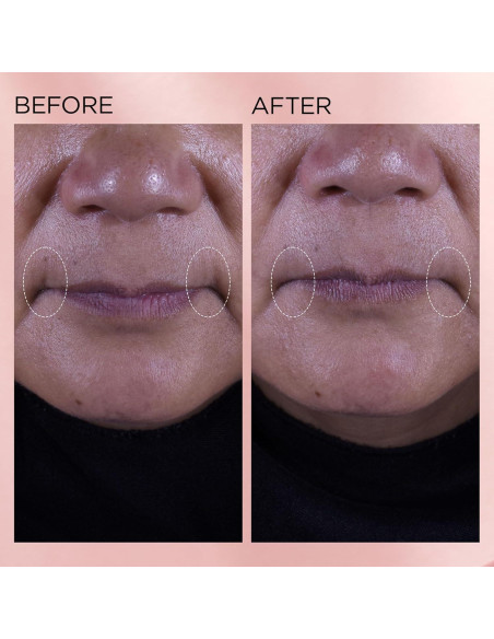 Crema Hidratante Facial Elizabeth Arden Retinol + HPR 50 ml