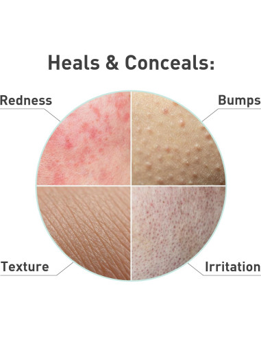 Suero Facial PROcure Rosacare 32ml - Hidratante para Rosácea