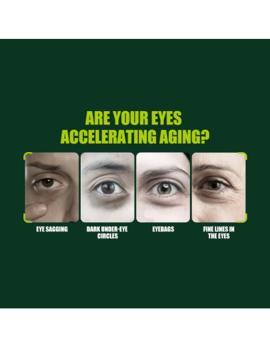 Crema para Ojos Aichun Beauty Raíz de Regaliz 25g Antiarrugas