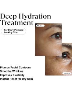 Sérum Hidratante Matkas 30 ml - Ácido Hialurónico y Niacinamida 2