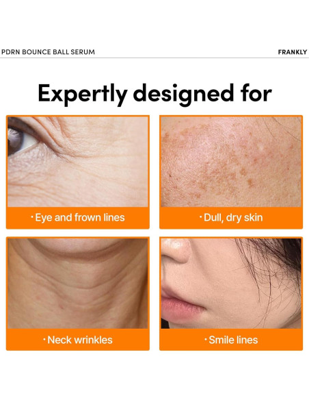 Sérum PDRN Frankly 30ml - Suero de ADN de Salmón para Piel Radiante