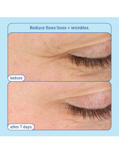 Crema para los Ojos Skinfix Barrier+ 14.17 g - Hidratante y Antienvejecimiento 2