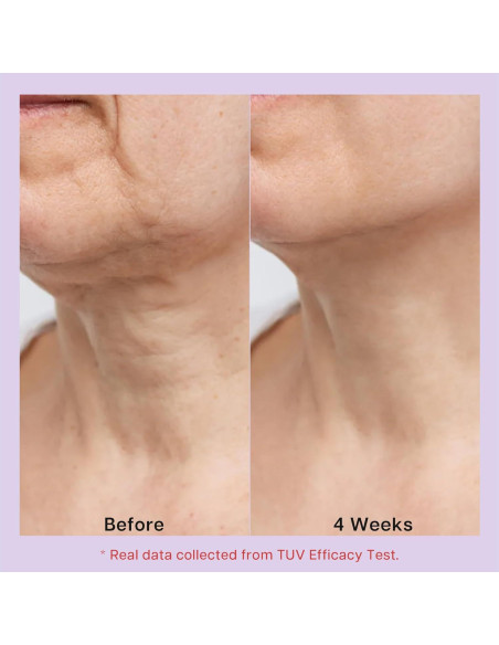 Crema reafirmante para el cuello RoscMinc 3 en 1 con AH-8