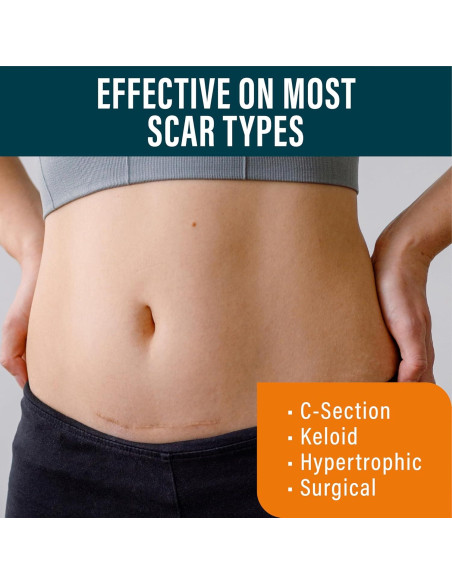 Crema Intensiva para Cicatrices NUVADERMIS 39.7 ml - Hidratante Nocturna