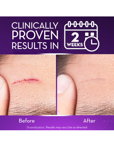 Cicatricure Gel Avanzado para Cicatrices 90 g - Tratamiento Facial y Corporal