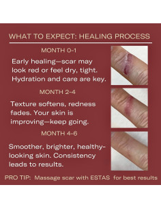 Crema para Cicatrices ESTAS Beauty 14.17 g - Vitamina E y C 2