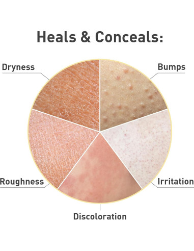 Crema Exfoliante para Queratosis Pilaris Procure 170 g