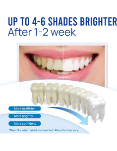 Bolígrafo Blanqueador de Dientes VieBeauti 30+ Usos Menta 2