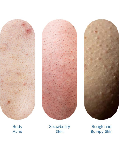 Gel de Ducha Be Bodywise 1% Ácido Salicílico 250ml