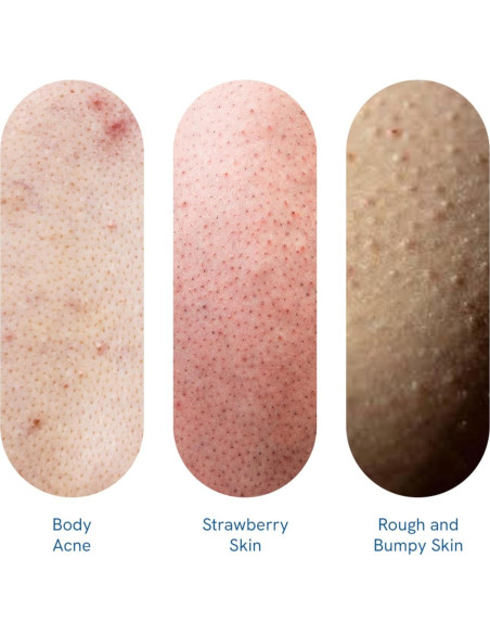 Gel de Ducha Be Bodywise 1% Ácido Salicílico 250ml