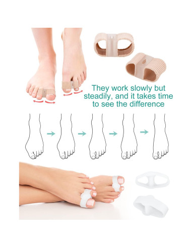 4 Piezas Separadores de Dedos BLATOWN Corrector Juanetes