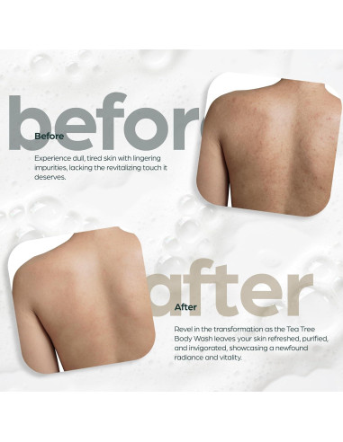 Jabón Corporal Antibacteriano Artnaturals 2x473ml Aceite de Árbol de Té