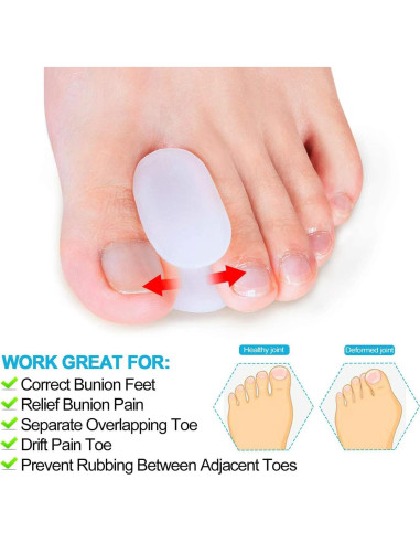 Separadores de Dedos Ortopédicos Povihome - 10 Piezas Talla L