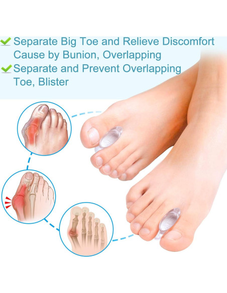Separadores de Dedos de Gel Povihome - Alivio Juanetes Grande