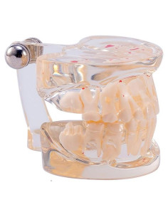Modelo Dental Pediátrico Easyinsmile TC6 Resina Transparente
