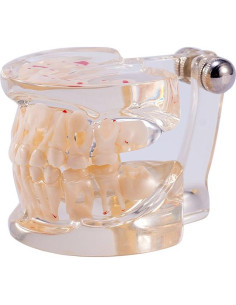 Modelo Dental Pediátrico Easyinsmile TC6 Resina Transparente 2
