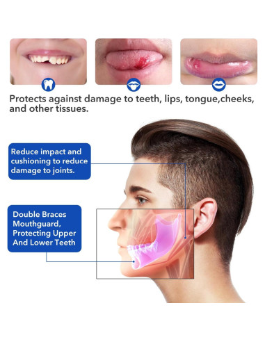 Protector Bucal Deportivo Doble Dick Being Azul Sin Hervir