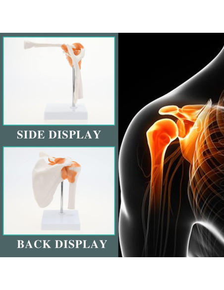 Modelo de Anatomía del Hombro RONTEN con Ligamentos Funcionales