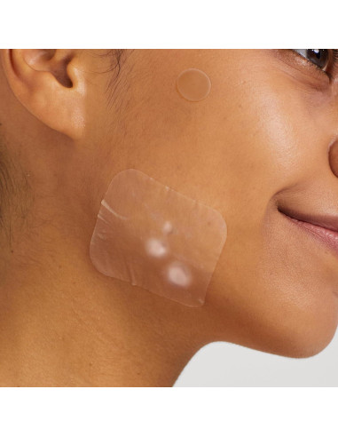 Parche para Acné Avarelle Hidrocoloide 40 Unidades Vegano