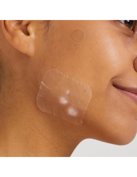 Parche para Acné Avarelle Hidrocoloide 40 Unidades Vegano Parche para Acné Avarelle Hidrocoloide 40 Unidades Vegano