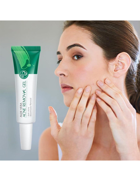 Gel de Aloe Vera Orgánico MIESCHER 68g - Hidratación y Alivio Solar