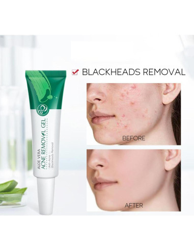 Gel de Aloe Vera Orgánico MIESCHER 68g - Hidratación y Alivio Solar