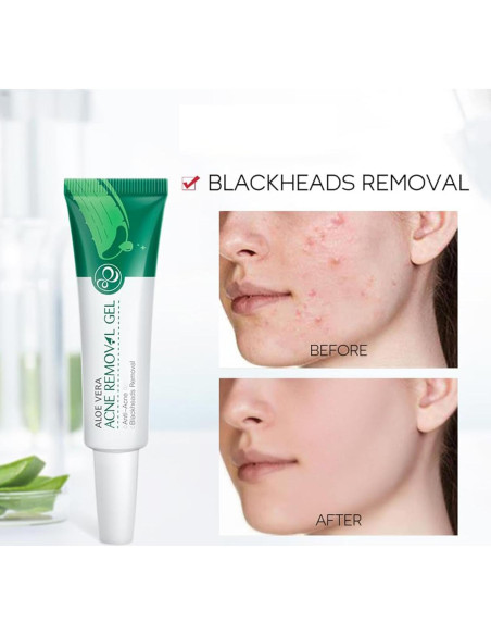 Gel de Aloe Vera Orgánico MIESCHER 68g - Hidratación y Alivio Solar