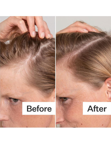 Exfoliante Cuero Cabelludo ACT+Acre 59ml | Ácido Salicílico, Papaya, Menta