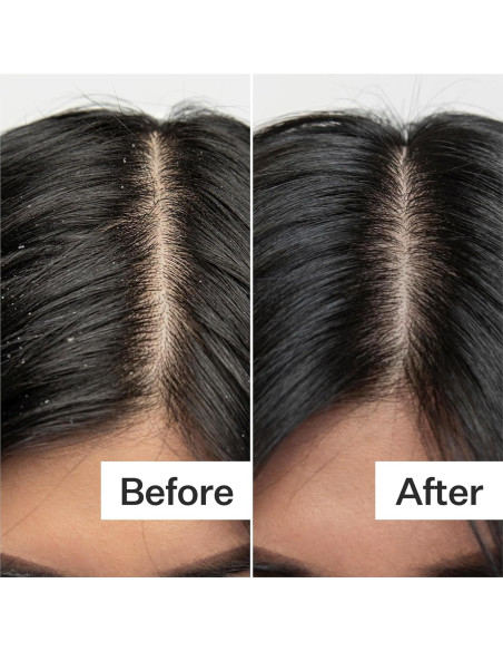 Exfoliante Cuero Cabelludo ACT+Acre 59ml | Ácido Salicílico, Papaya, Menta