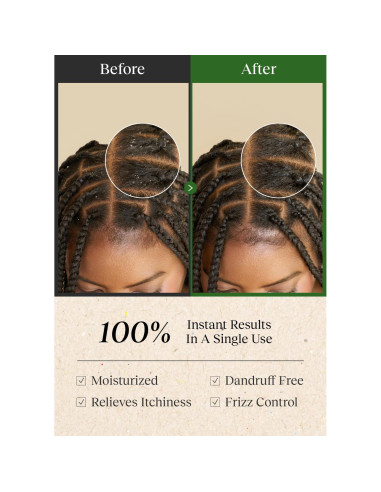 Tónico Limpiador del Cuero Cabelludo Bephor 200ml Sin Enjuague