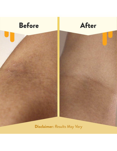 Baño de Burbuja de Avena Eczema Honey 340g - Gel de Ducha Sin Fragancia