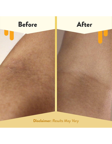 Baño de Burbuja de Avena Eczema Honey 340g - Gel de Ducha Sin Fragancia