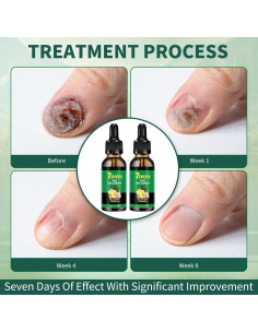 Tratamiento de Uñas de Jengibre YSeaWolf 60ml - Suero Crecimiento 2