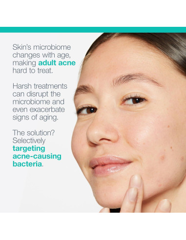 Hidratante Facial Acne Biotic Dermalogica 50 ml - Previene Brotes