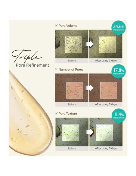 ACWELL Gel Limpiador Facial Espumoso pH Equilibrante 160 ml