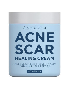 Crema para Cicatrices de Acné Ayadara 59 ml - Tratamiento Facial y Corporal