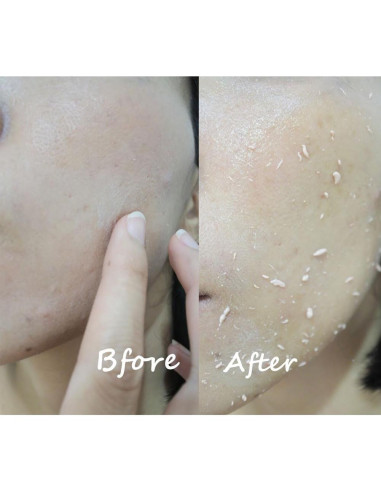 Exfoliante de Gel de Leche Scentio 100 ml - Suaviza y Renueva