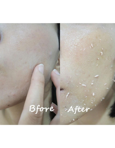 Exfoliante de Gel de Leche Scentio 100 ml - Suaviza y Renueva