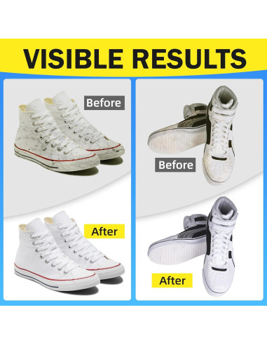 Kit Limpiador de Zapatos TidyBond 191.5 g - Espuma Sin Enjuague