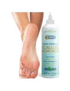 Gel Removedor de Callos para Pies Love, Lori 170g - Acción Rápida