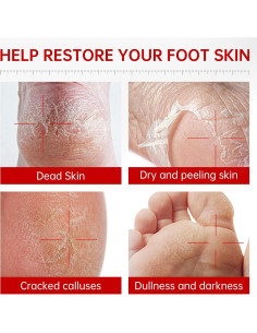 Mascarillas Exfoliantes para Pies QQE - Hidratantes y Reparadoras 2