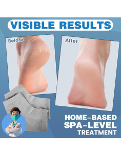 Calcetines Hidratantes TEAWOO - 6 Pares para Talones Secos 2