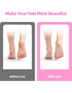 Removedor de Callos Eléctrico MARSDREAMS 802 Inalámbrico 2